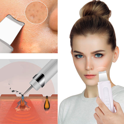 Electric Pore Cleaning Ultrasonic Peeling Machine
